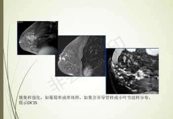 短视频账号的数据分析怎么写 数据分析报告怎么写