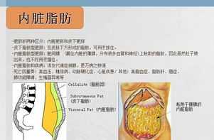 resistive translation resistive