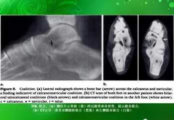 ankle什么意思 ankle是什么意思译