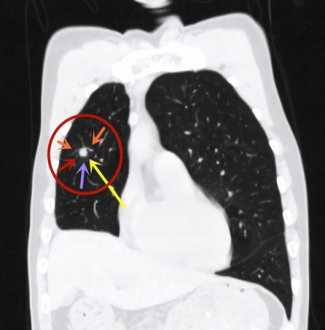 蓝轩宇的孩子叫什么 lung